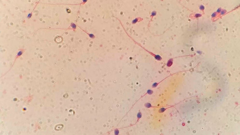 Investigación de HyperSperm en el laboratorio
