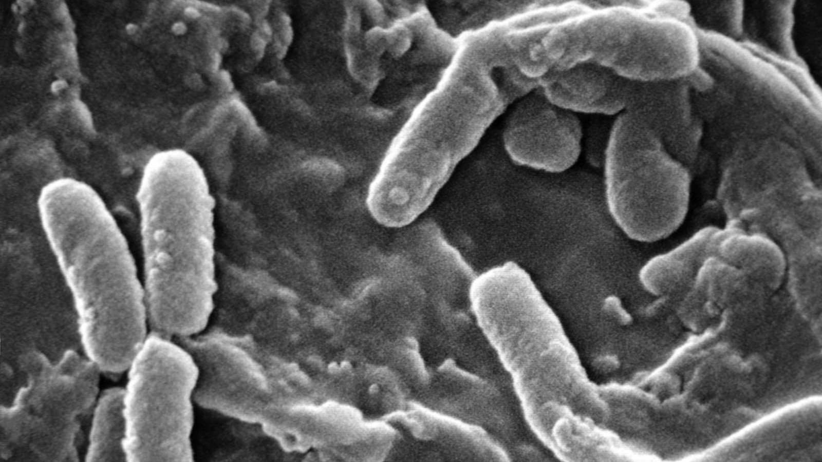 Resistencia a antibióticos: un solo aminoácido le quita eficacia a dos inhibidores modernos